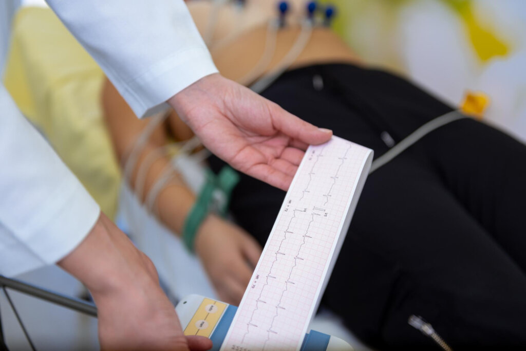 Ukážka výsledkov EKG