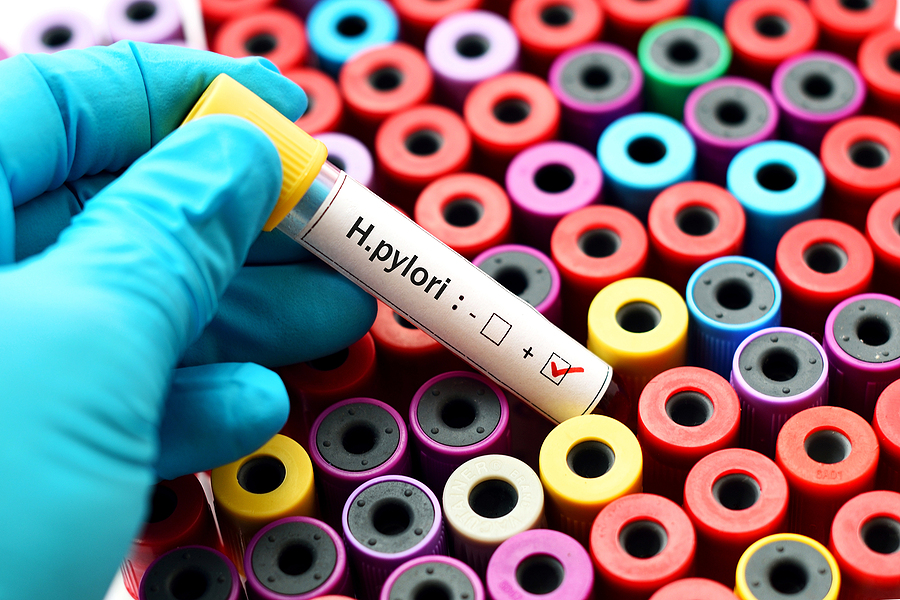 Skúmavka s krvou určená na vyšetrenie prítomnosti helicobater pylori
