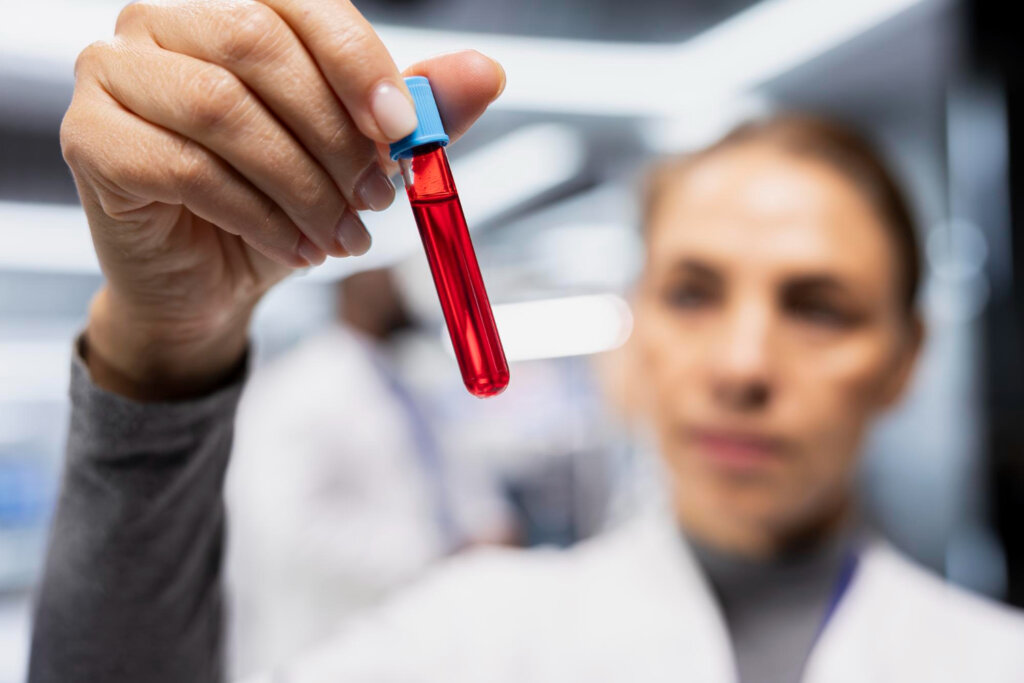 Žena laborantka drží skúmavka plnú krvi ktorá bude poslaná na test na porfýriu