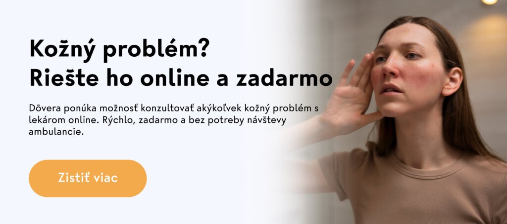 Bener: Kožné online vyšetrenie od Dôvery zadarmo.