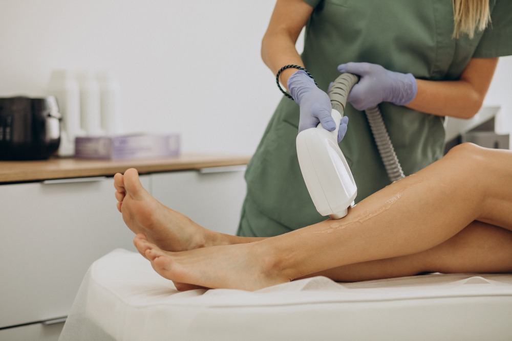 Laserová epilácia ako prevencia pred zarastením chĺpkov