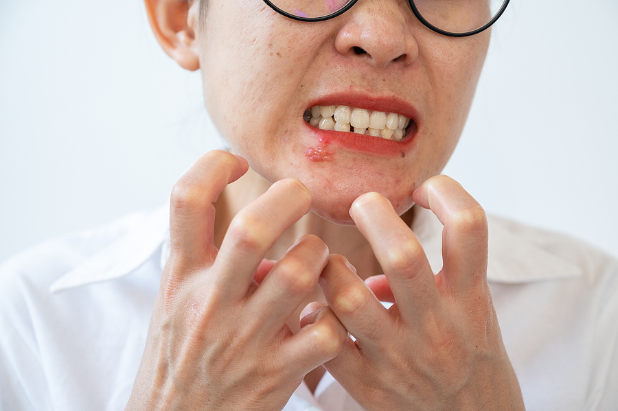 Nahnevana zena s aktivnym herpesom okolo pier