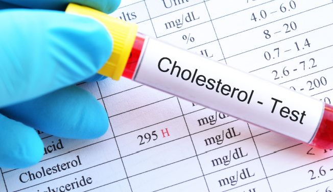 Cholesterol test