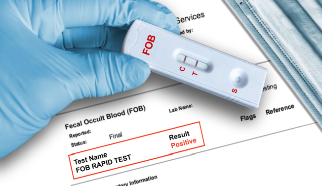 FOB test na okultné krvácanie