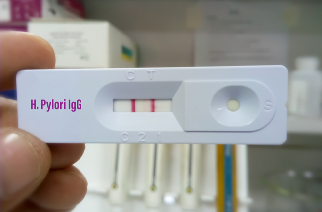 Helicobacter pylori test