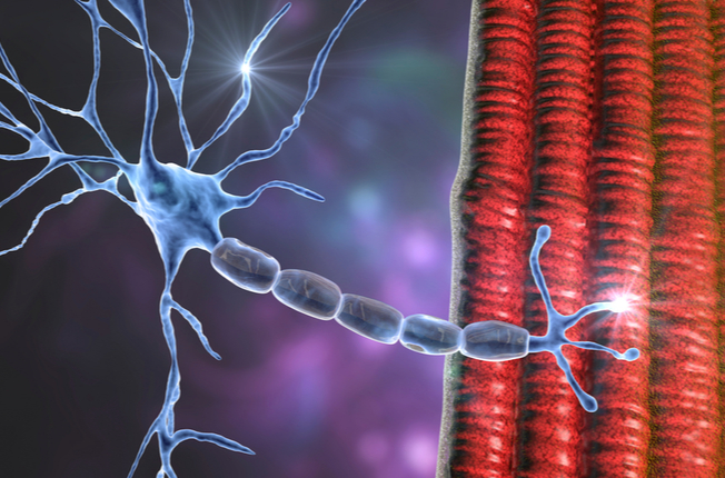 Pompeho choroba sa označuje aj ako neuromuskulárna porucha. 