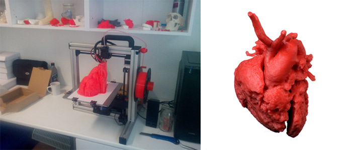 3D FDM tlač presného modelu srdca 3:1. Model srdca na DLP tlačiarni Titan 1:1