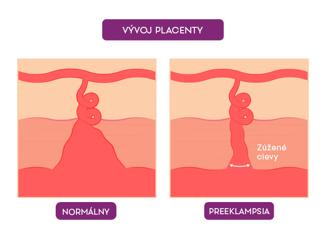 Vývoj placenty